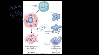 4  Introduction to Pathology  Necrosis vs Apoptosis [upl. by Nirda]