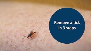 Remove a tick in 3 steps [upl. by Nannaihr214]